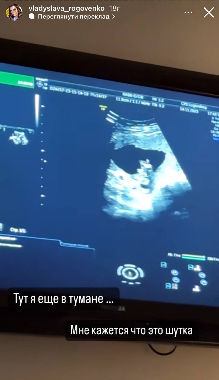 "Плакала довго": вагітна зірка "Пацанок" поскаржилася на лікарську помилку